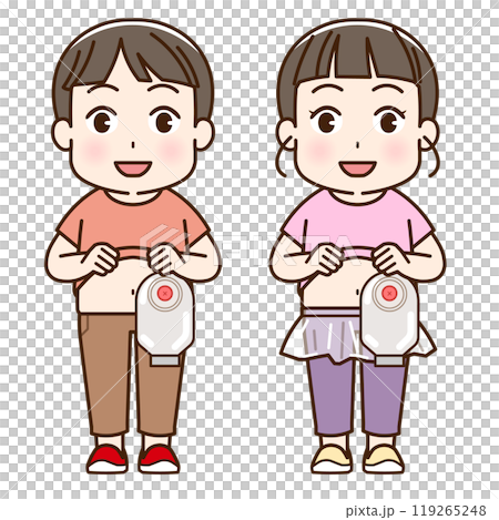 人工肛門、ストーマ、大腸、子供、こども、赤ちゃん、イラスト、illustration 119265248