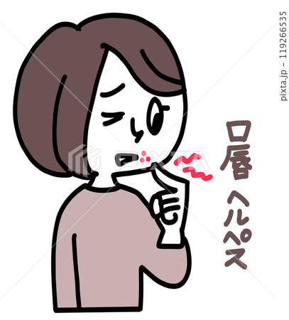 口唇ヘルペス 口唇ヘルペス 119266535