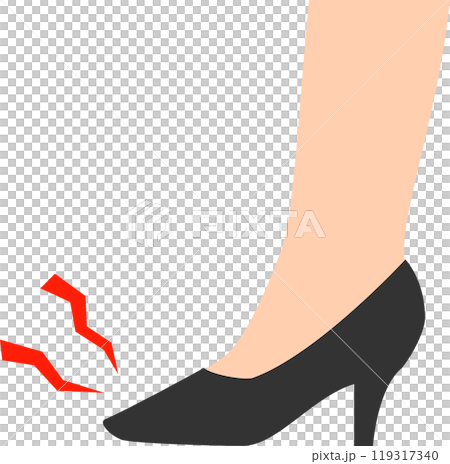 ハイヒールの靴を履いて痛みがある足 ハイヒールの靴を履いて痛みがある足 119317340
