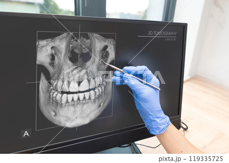 Dentist examine a patient's teeth Dentist examine a patient's teeth 119335725