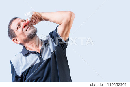 Senior man with irritated nose isolated. man with red nose cold, Concept of sinusitis. Person with nasal congestion 119352361