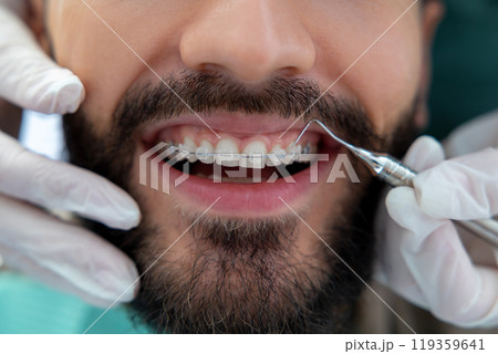 Doctor in dental clinic wearing gloves carefully inspecting patient’s mouth with precise instruments 119359641