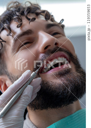 Unknown dentist doing oral examination with advanced dental equipment for patient 119359653
