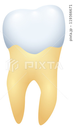 Veneer illustration. Enamel prosthesis. Orthodontic color illustration Veneer illustration. Enamel prosthesis. Orthodontic color illustration 119366671