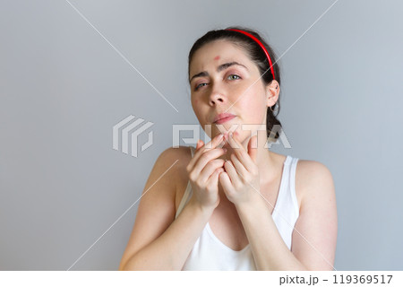 A young pretty brunette squeezes pimples on her chin. The concept of cosmetology and acne control, adolescence. Copy space 119369517