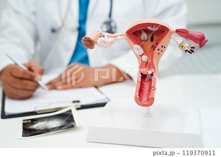 Uterus, doctor holding human anatomy model for study diagnosis and treatment in hospital. Uterus, doctor holding human anatomy model for study diagnosis and treatment in hospital. 119370911
