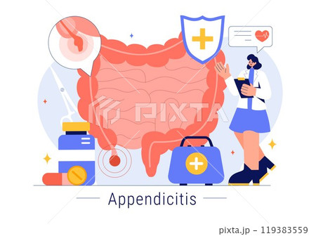 Appendicitis Vector Illustration Featuring Inflammation of the Appendix and Stomach Treatment in a Healthcare Flat Style Cartoon Background 119383559
