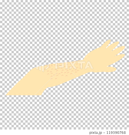 皮膚のトラブル＿毛孔性苔癬（もうこうせいたいせん）湿疹や鳥肌のようなブツブツは乾燥が原因かも 119390768