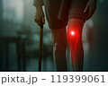 Elderly Woman Suffering from Knee Pain Using a Cane 119399061