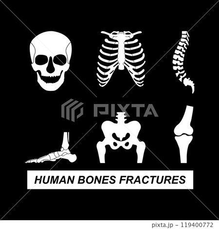 Human bones fractures icon 119400772