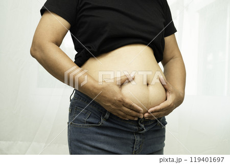 Overweight asian woman use hand to squeeze fat belly big size overweight and obesity. 119401697