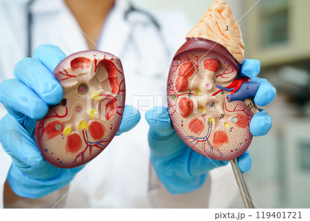 Chronic kidney disease, doctor with model for treatment urinary system, urology, Estimated glomerular filtration rate eGFR. 119401721