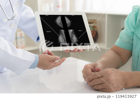 doctor patient mammography doctor patient mammography 119413927