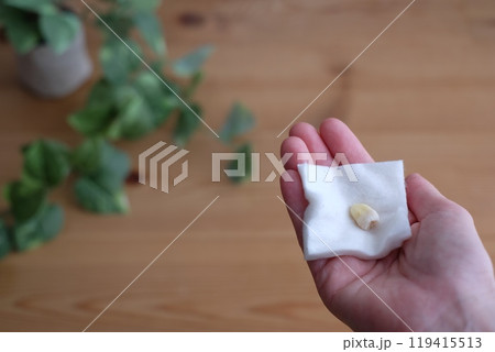 親知らずの抜歯 119415513