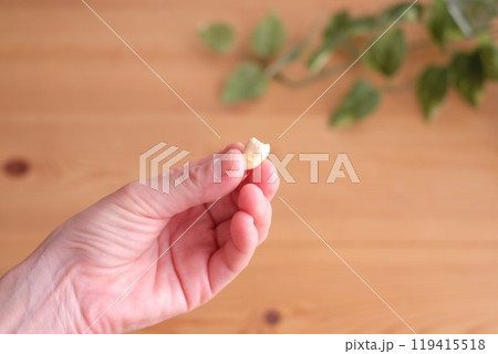 親知らずの抜歯 119415518