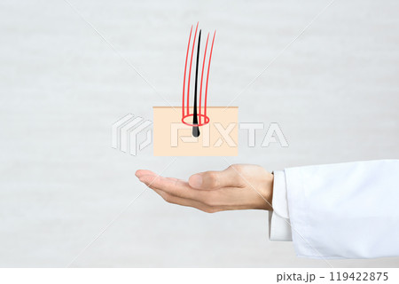 医者の手と増毛を表したイラストの合成画像 119422875