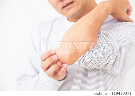 乾燥肌に苦しむミドル男性 119459371