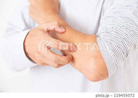 乾燥肌に苦しむミドル男性 119459372