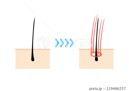 増毛エクステを施すイメージイラスト 増毛エクステを施すイメージイラスト 119466257