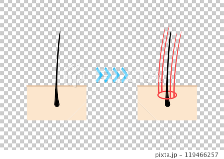増毛エクステを施すイメージイラスト 増毛エクステを施すイメージイラスト 119466257