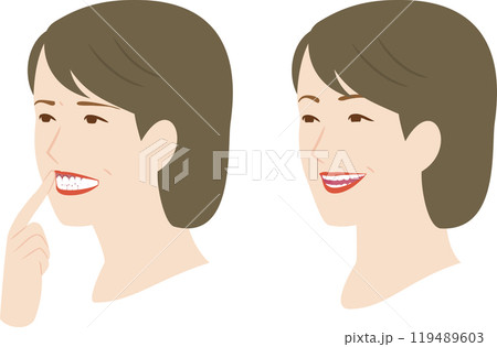 歯槽膿漏、歯周病で腫れた歯茎と健康な歯の笑顔の女性 歯槽膿漏、歯周病で腫れた歯茎と健康な歯の笑顔の女性 119489603