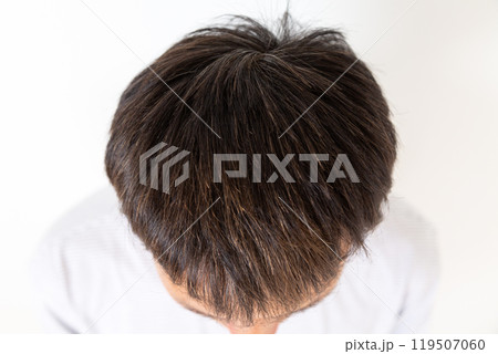 ミドル男性の頭髪 119507060