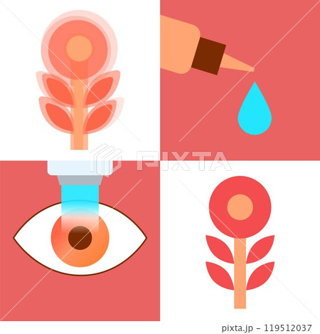 Lasik eye surgery 119512037