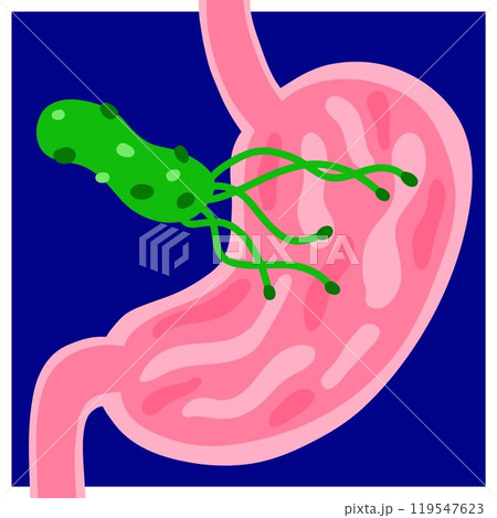 Helicobacter pylori vector illustration. Cartoon stomach, bacteria Helicobacter pylori vector illustration. Cartoon stomach, bacteria 119547623