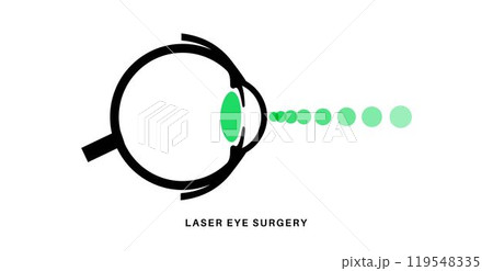 Lasik eye surgery Lasik eye surgery 119548335