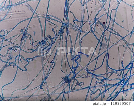 染色されたクモノスカビの顕微鏡写真 染色されたクモノスカビの顕微鏡写真 119559507