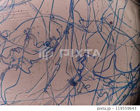 滑らかに平広がるクモノスカビの菌糸 119559643