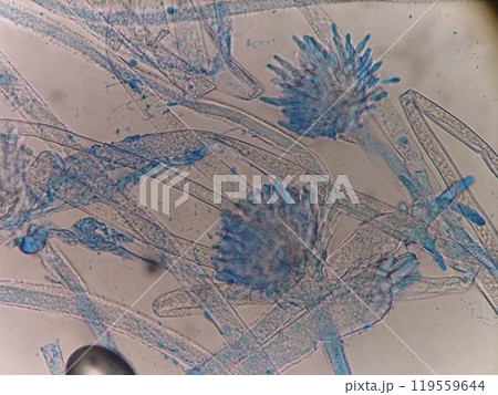 麹カビの菌糸と分生子 119559644
