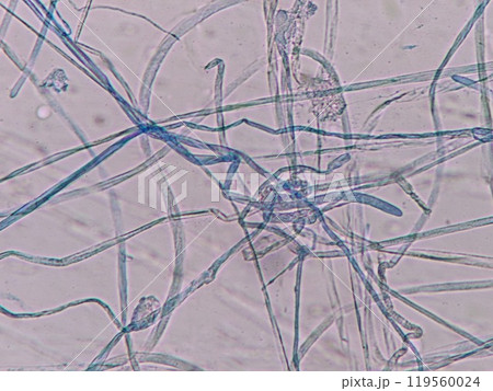 テンペ菌の菌糸 119560024