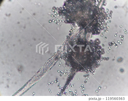 黒麹カビの大きな分生子 黒麹カビの大きな分生子 119560363