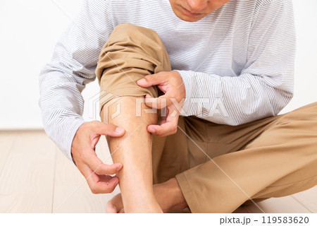 足の痒みに苦しむミドル男性 119583620