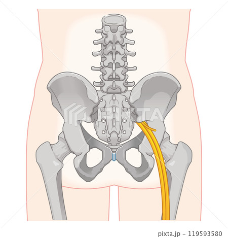 坐骨神経、sciatic nerve、イラスト、illustration 坐骨神経、sciatic nerve、イラスト、illustration 119593580