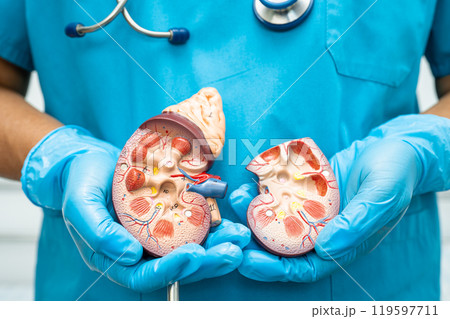 Kidney disease, Chronic kidney disease ckd, Doctor hold human model to treat and study in hospital. 119597711
