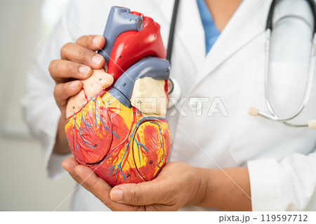 Cardiovascular disease CVD, Asian doctor holding human anatomy model for learn and treat heart disease. 119597712