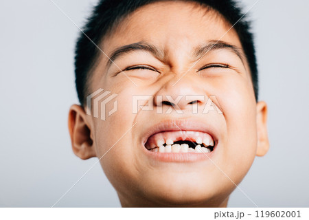 Child smile reveals lost upper tooth gap. Dental growth isolated on white. Joyful tooth fairy moment. Children show teeth new gap, dentist problems. little boy no tooth 119602001