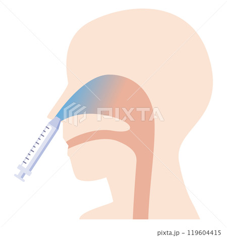 経鼻ワクチン接種のイラスト 経鼻ワクチン接種のイラスト 119604415