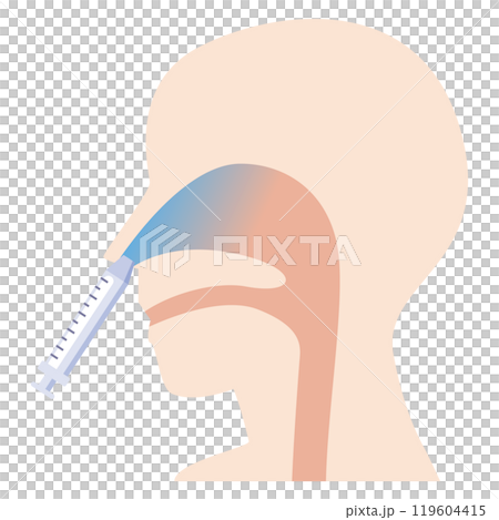 経鼻ワクチン接種のイラスト 経鼻ワクチン接種のイラスト 119604415