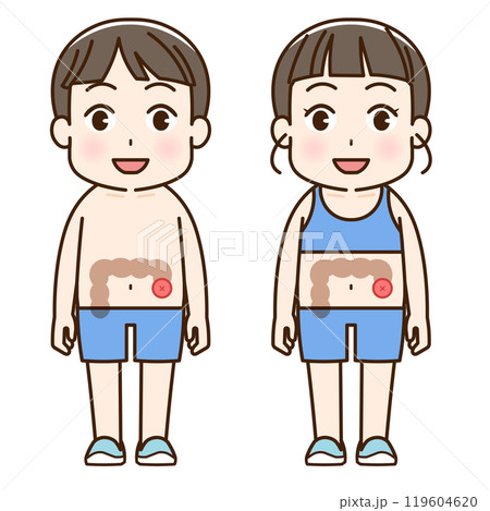 人工肛門、ストーマ、大腸、子供、こども、イラスト、illustration 人工肛門、ストーマ、大腸、子供、こども、イラスト、illustration 119604620