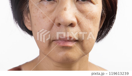 Senior asian woman worry about eye bags and dark spot. 119613239