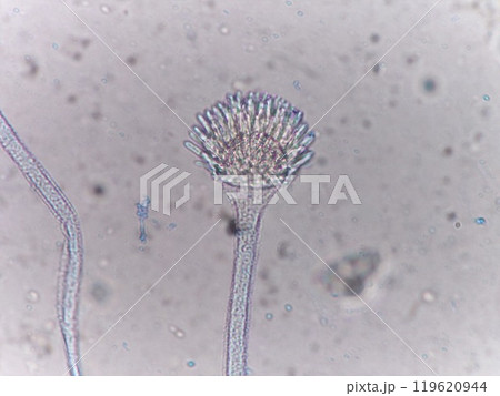 タンポポのように見えるコウジカビの分生子 119620944