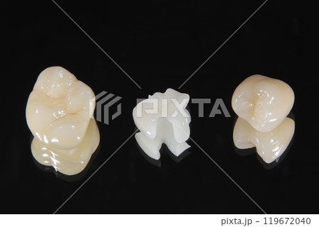 きれいなセラミックの歯にしませんか 119672040