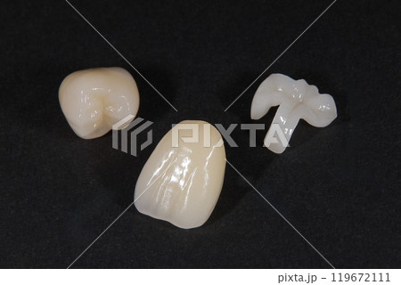 きれいなセラミックの歯にしませんか 119672111