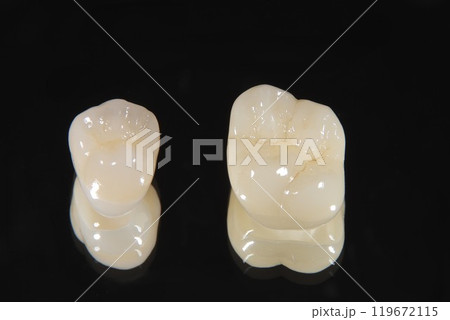 きれいなセラミックの歯にしませんか 119672115