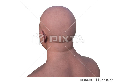 A man's hairless head from side back view, 3D illustration A man's hairless head from side back view, 3D illustration 119674077