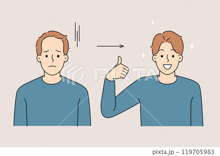 Young man had hair extension surgery to get good hairstyle and beautiful appearance 119705983