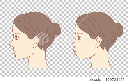 Comparison illustration of side face correction for protruding mouth 119723423